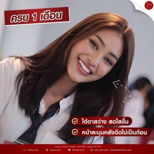 รีวิวfillerใต้ตา03