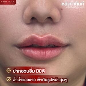 photo_2567-06-22 15.22.59