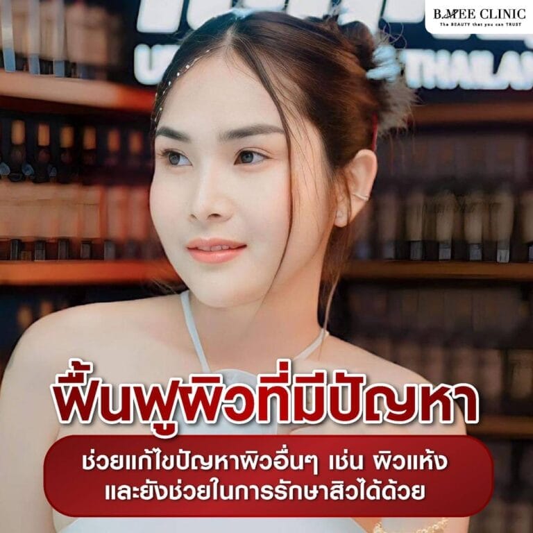 เมโสหน้าใส Info 1