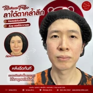 กระชับ-01