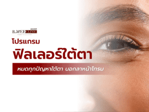 ฟิลเลอร์ใต้ตา ดีไหม