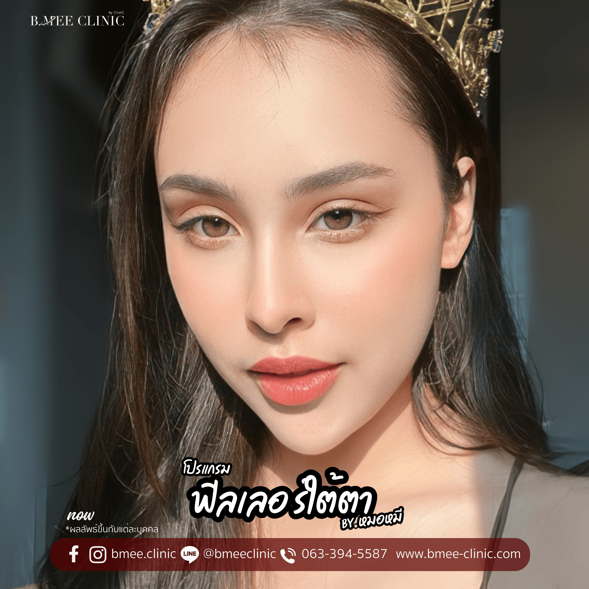 โปรแกรมฟิลเลอร์ filler