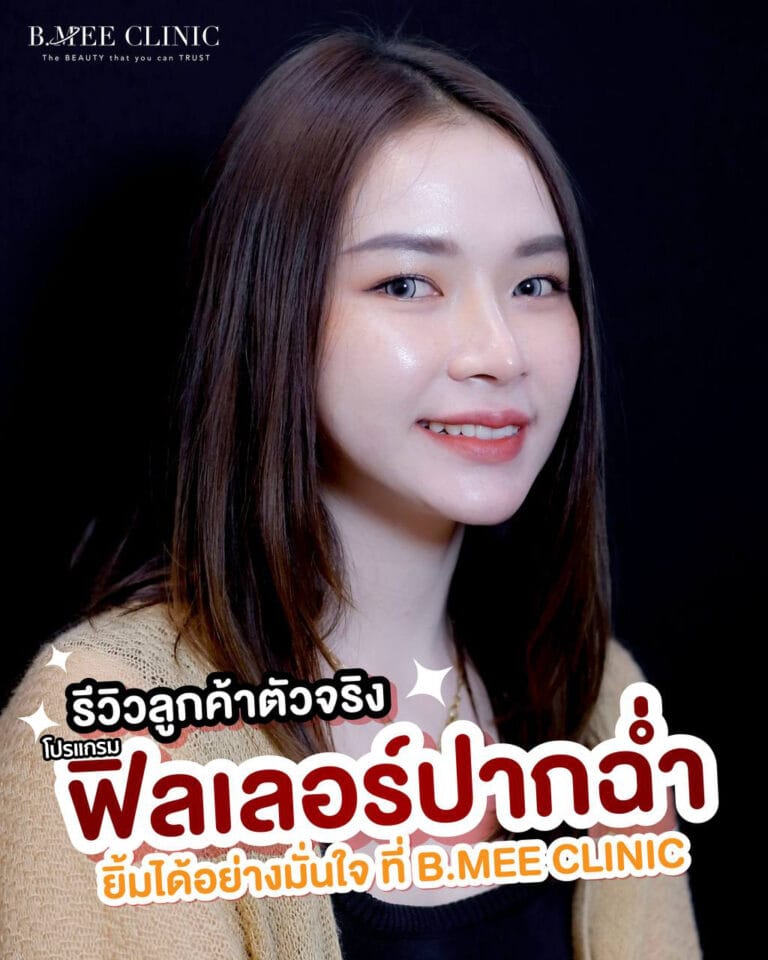 โปรแกรมฟิลเลอร์ filler