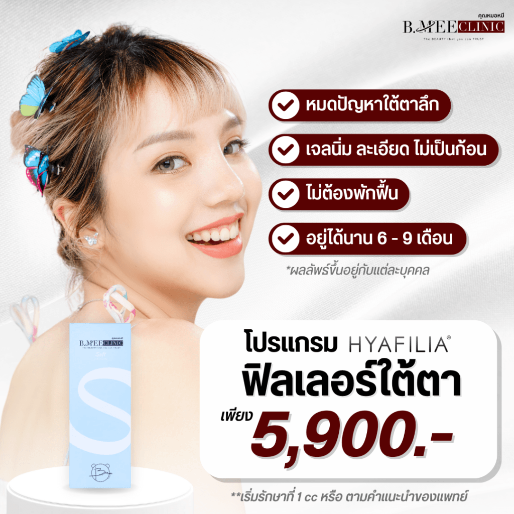 โปรโมชั่น ฟิลเลอร์ใต้ตา Hyafilia