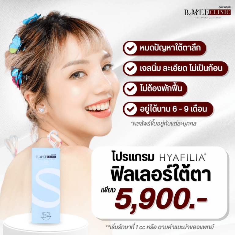 โปรโมชั่น ฟิลเลอร์ใต้ตา Hyafilia