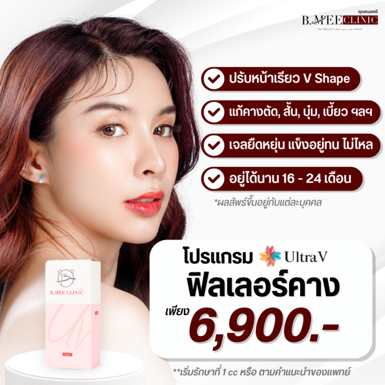 โปรโมชั่น ฟิลเลอร์คาง Ultra V
