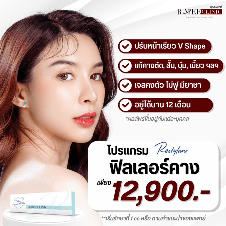 โปรโมชั่น ฟิลเลอร์คาง Restylane