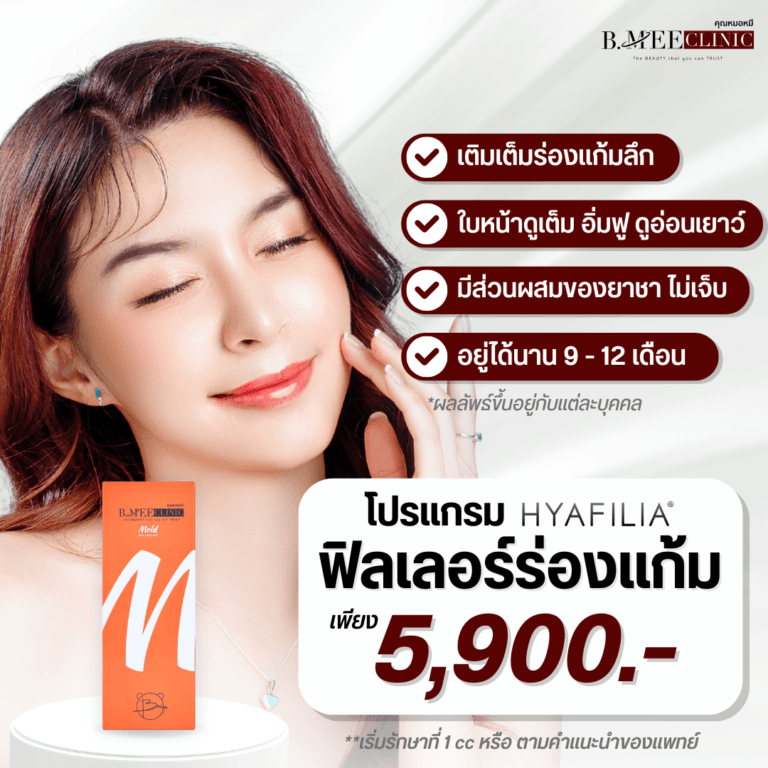 โปรโมชั่น ฟิลเลอร์ร่องแก้ม Hyafilia