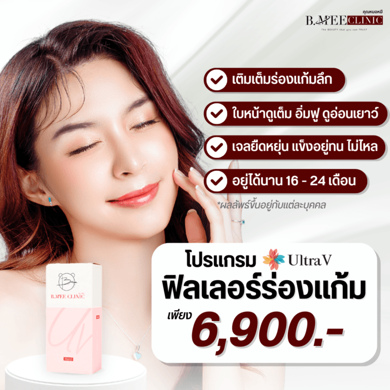 โปรโมชั่น ฟิลเลอร์ร่องแก้ม Ultra V