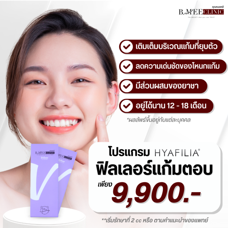 โปรโมชั่น ฟิลเลอร์แก้มตอบ Hyafilia