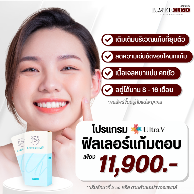 โปรโมชั่น ฟิลเลอร์แก้มตอบ Ultra V