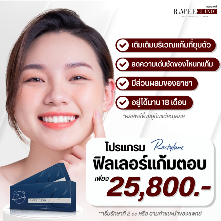 โปรโมชั่น ฟิลเลอร์แก้มตอบ Restylane