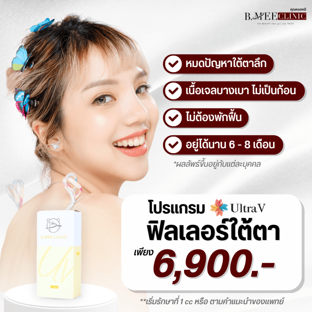 โปรโมชั่น ฟิลเลอร์ใต้ตา Ultra V
