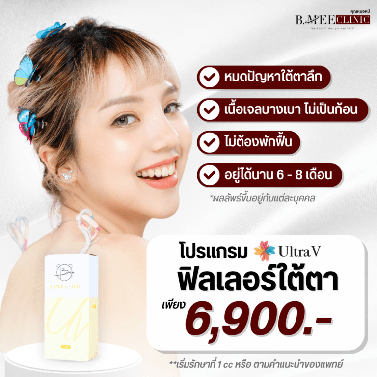 โปรโมชั่น ฟิลเลอร์ใต้ตา Ultra V