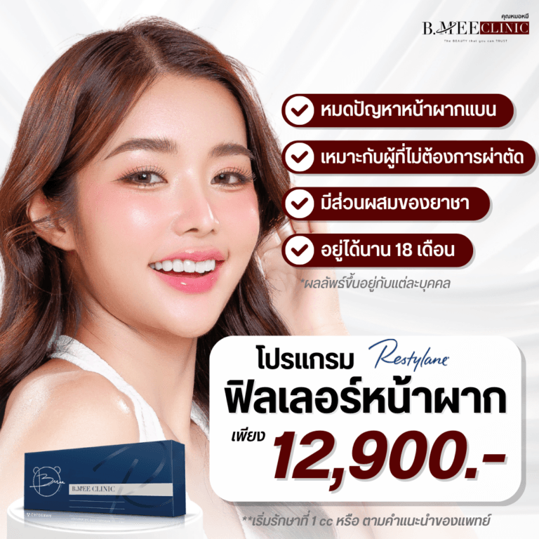 โปรโมชั่น ฟิลเลอร์หน้าผาก Restylane