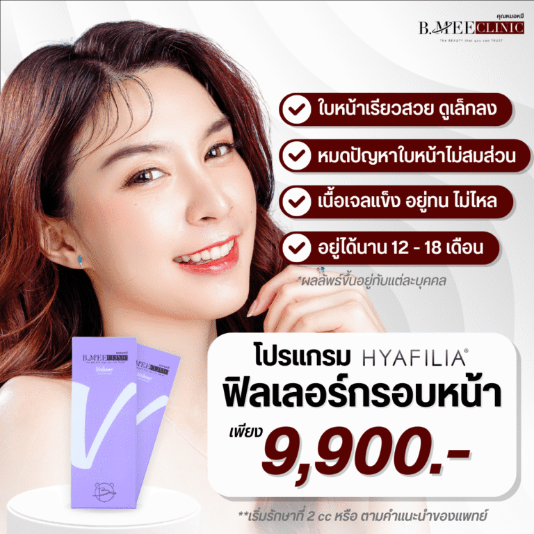 โปรโมชั่น ฟิลเลอร์กรอบหน้า Hyafilia