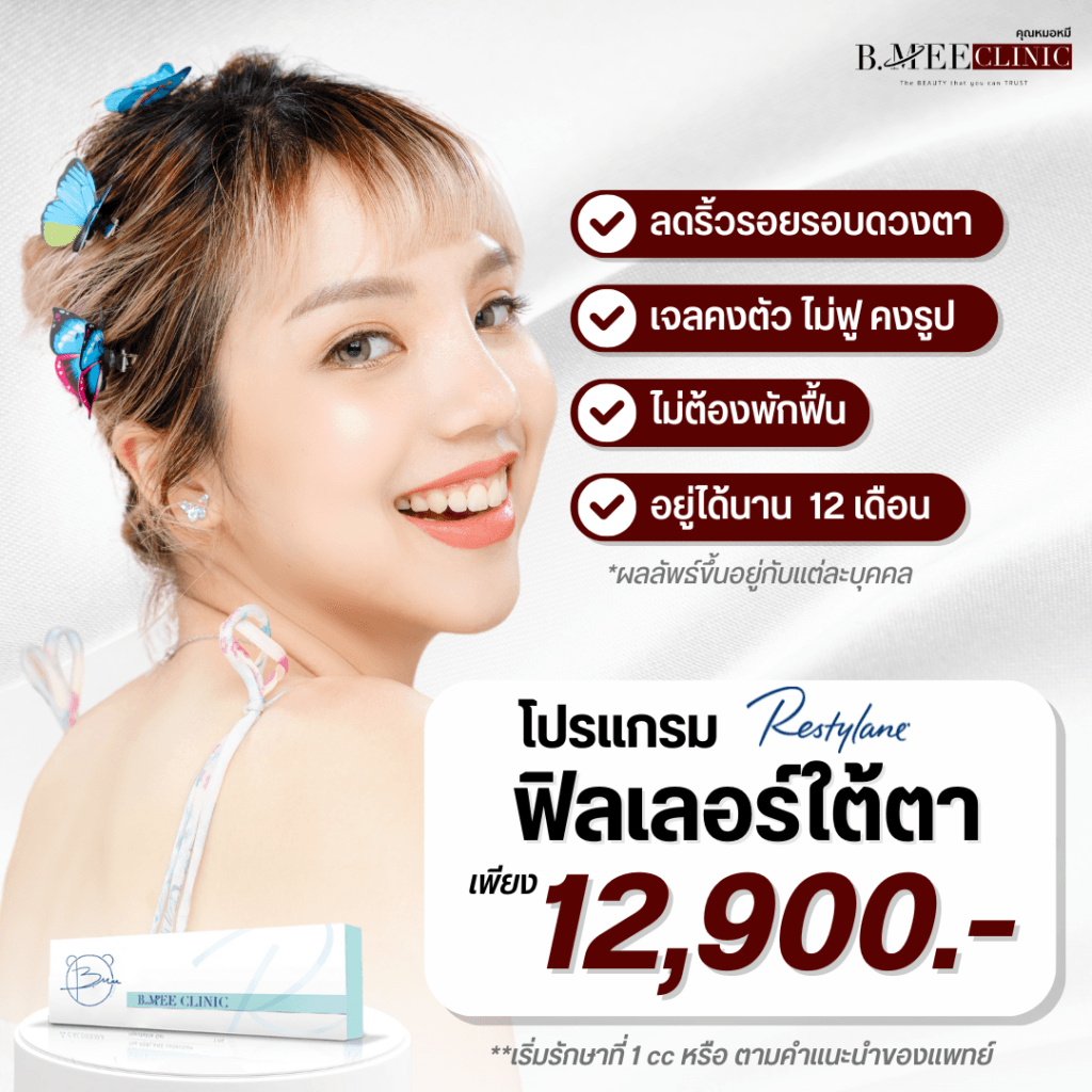 โปรโมชั่น ฟิลเลอร์ใต้ตา Restylane