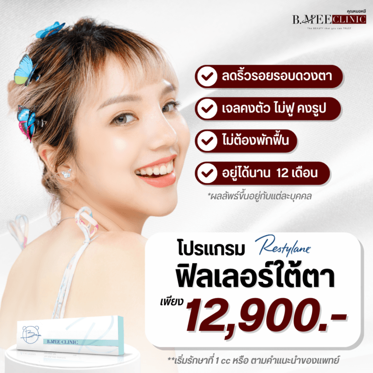 โปรโมชั่น ฟิลเลอร์ใต้ตา Restylane