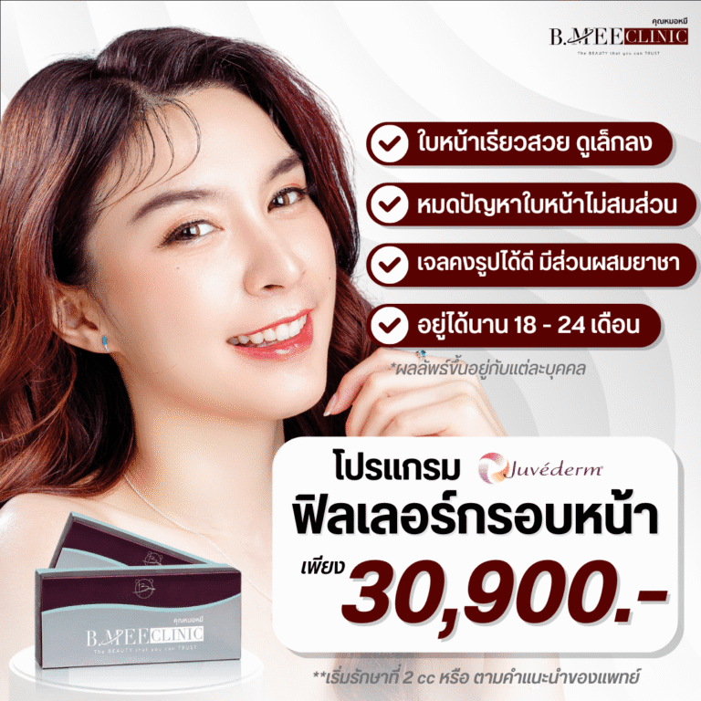 โปรโมชั่น ฟิลเลอร์กรอบหน้า Juvederm