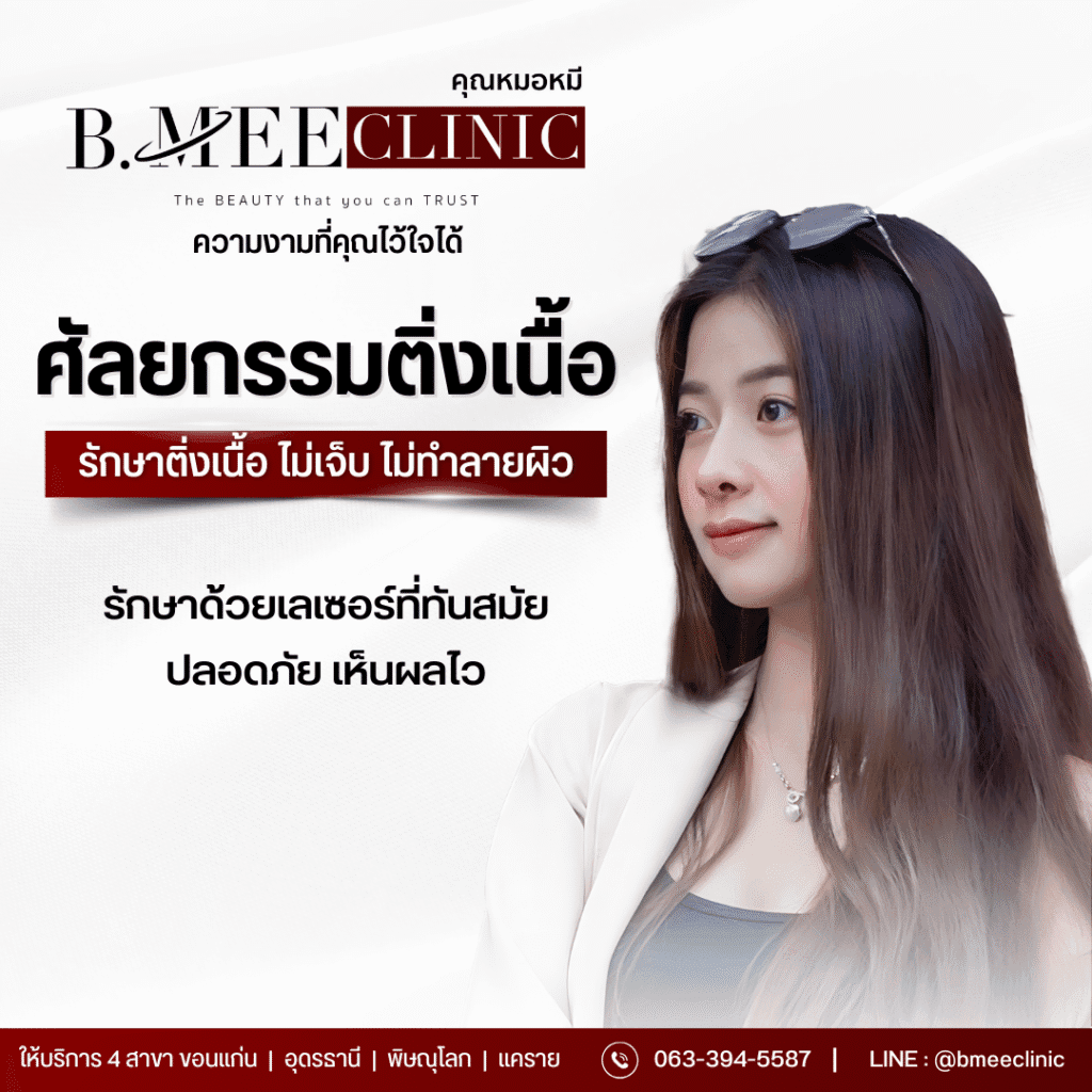 รักษาติ่งเนื้อ ขอนแก่น