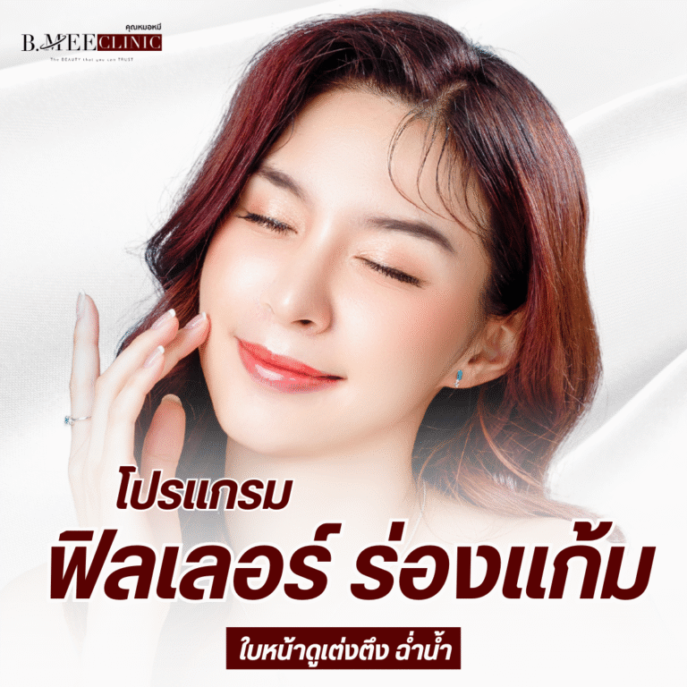 ฟิลเลอร์ ร่องแก้ม B.Mee Clinic