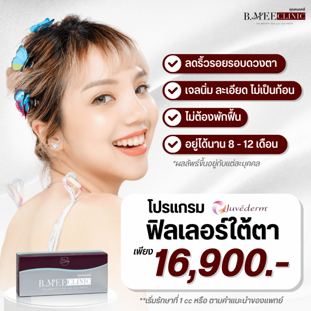 โปรโมชั่น ฟิลเลอร์ใต้ตา Juvederm