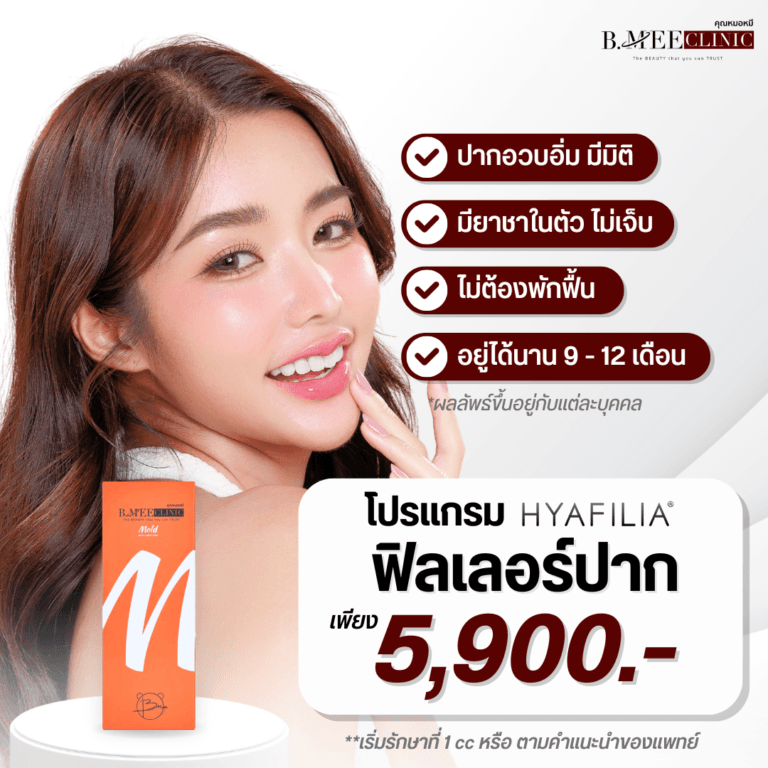 โปรโมชั่น ฟิลเลอร์ปาก Hyafilia