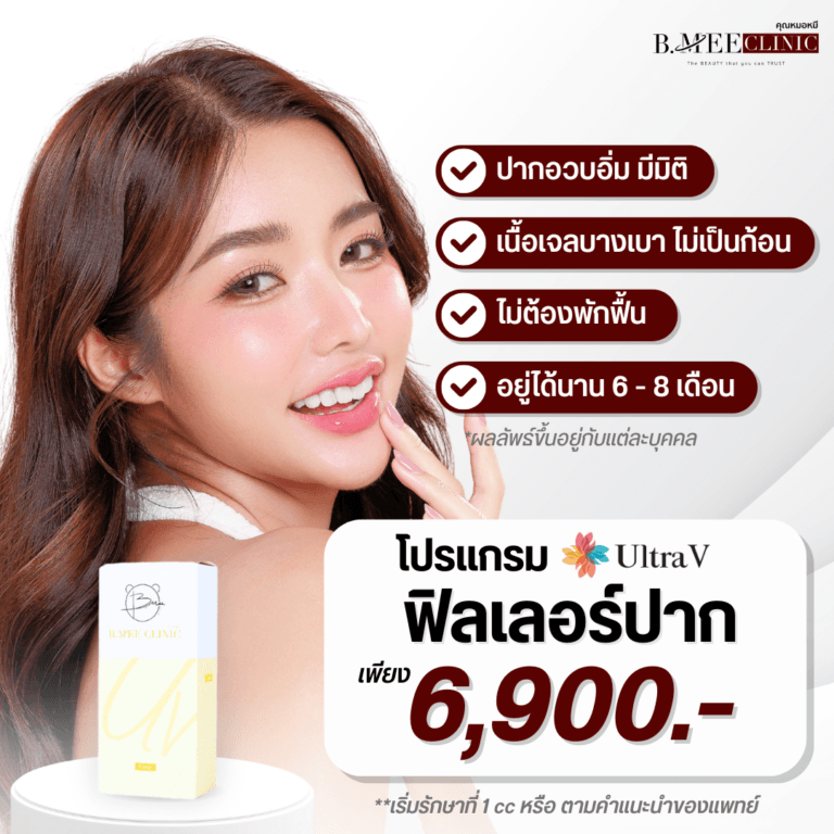 โปรโมชั่น ฟิลเลอร์ปาก Ultra V