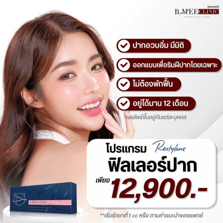 โปรโมชั่น ฟิลเลอร์ปาก Restylane