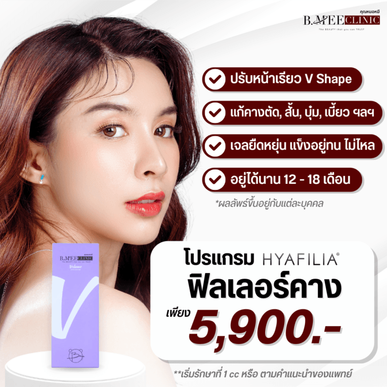 โปรโมชั่น ฟิลเลอร์คาง Hyafilia