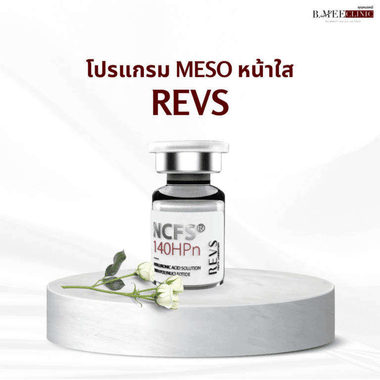 เมโส หน้าใส REVS