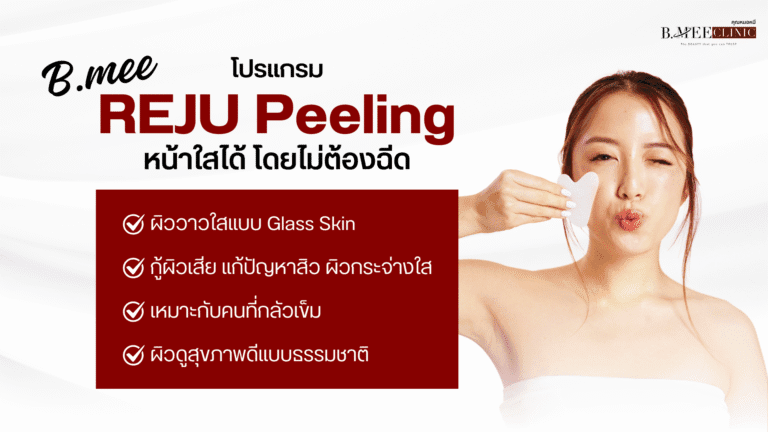 ข้อดีของ peeling