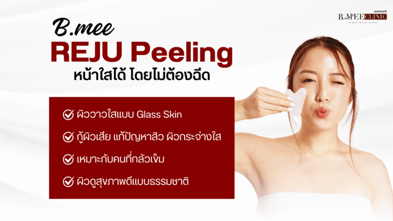ข้อดีของ peeling