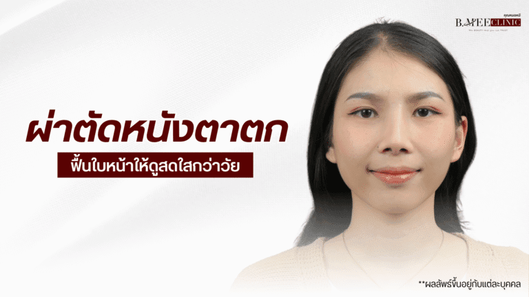 ผา่ตัดหนังตาตก b.mee clinic