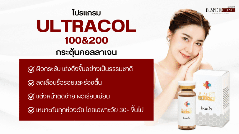 ข้อดีของ Ultracol