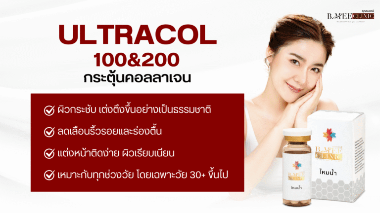 ข้อดีของ Ultracol