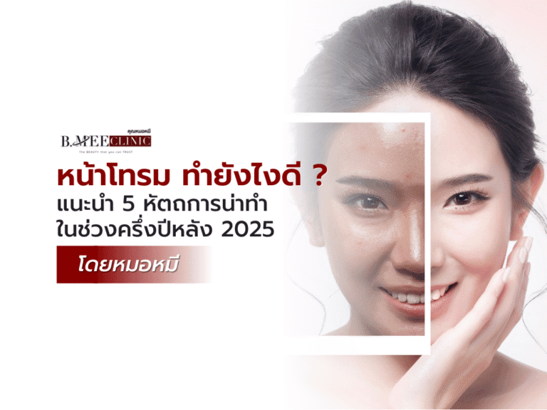 หน้าโทรม ทำยังไงดี