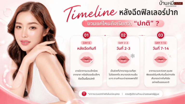 Timeline หลังฉีดฟิลเลอร์ปาก