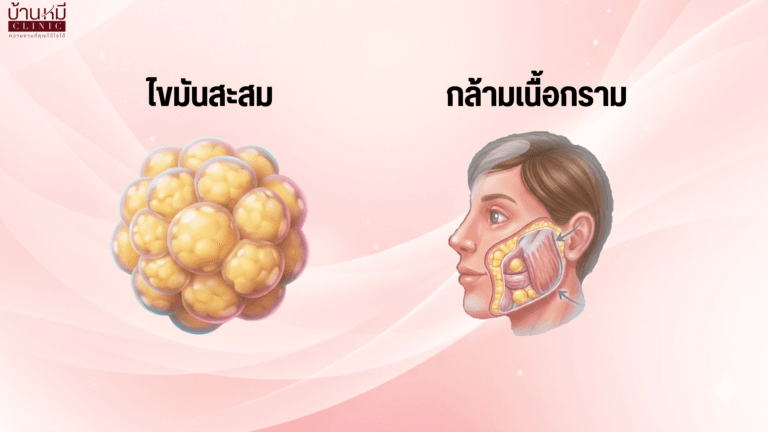 กล้ามเนื้อหน้าและไขมัน