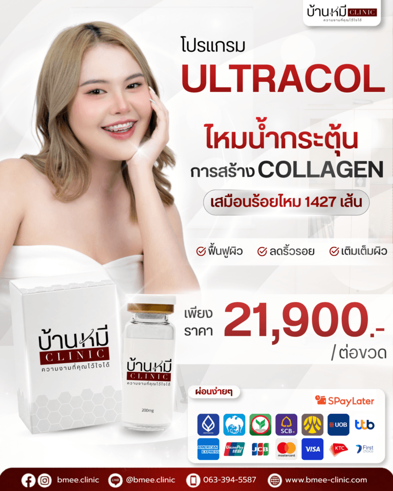 Ultracol